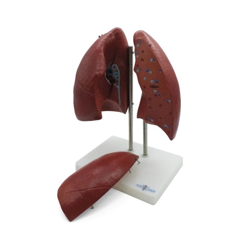 PULMONES 4 PARTES
